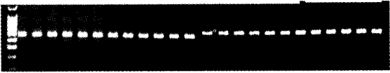 图1 G3PDH基因RT-PCR产物电泳吲