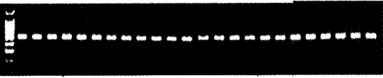 图4 5-HTRIAmRNA基因RT-PCR分析RT-PCR产物电泳图